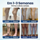 Microneedle Patch - EXTERMINADOR DE VARIZES