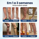 Microneedle Patch - EXTERMINADOR DE VARIZES