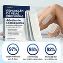 Microneedle Patch - EXTERMINADOR DE VARIZES
