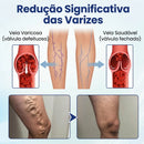 Microneedle Patch - EXTERMINADOR DE VARIZES